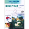 

脾切除门奇断流术DVD