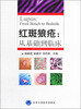 

红斑狼疮从基础到临床