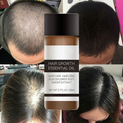 

Fast Powerful Hair Growth Essence Products Essential Oil Liquid Treatment Preventing Hair Loss Hair Care Andrea 20ml