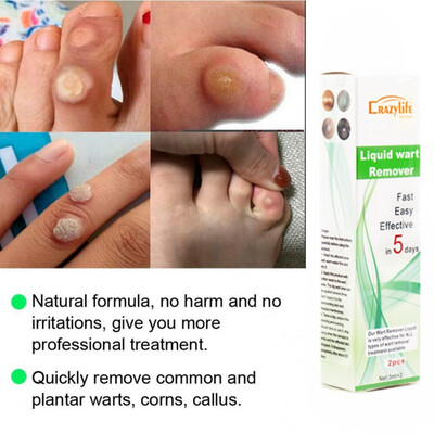 

Remove Old Sputum To Remove Dead Skin Pen To Beautify Skin Care