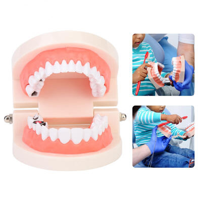

Greensen Preschool Teaching Tooth Model Tooth Decay Model Dental Caries Tooth Model