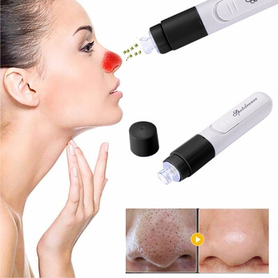 

〖Follure〗Cleaner Vacuum Suction Facia Blackhead Removal Skin Care Cleansing Tool
