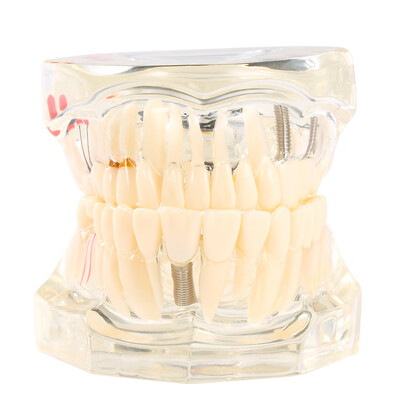 

TransparentColored Teeth Learners Tool Adult Typodont Removable Teeth Model for Dentist And Children