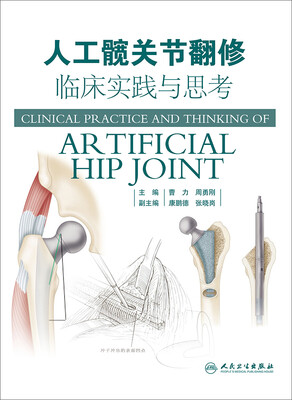 

人工髋关节翻修临床实践与思考
