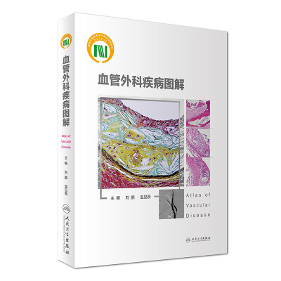 

血管外科疾病图解
