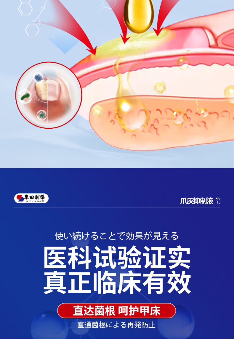 东田日本灰指甲药第1名根i治正品真菌灰指甲抑菌专用特效进口感染增厚灰指甲进口专用抑菌 特效】1盒升级款详情图片15