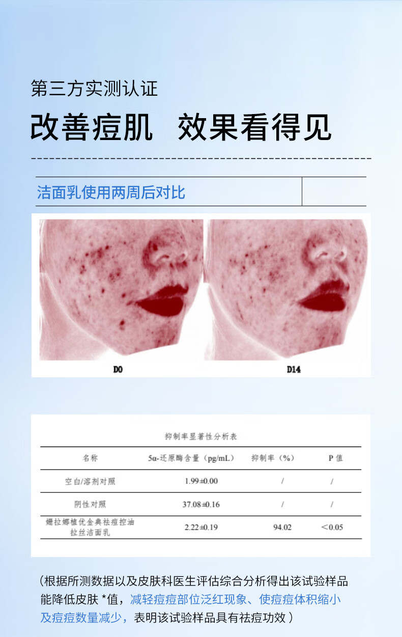 姗拉娜洗面奶清洁护肤学生男女士专用洁面乳泡沫绵密礼物 【温和洁面】清滢保湿洁面100g