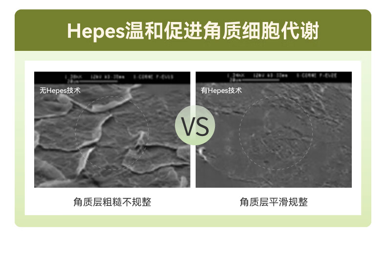 HBN发光水α熊果苷精萃水提亮肤色补水保湿爽肤水湿敷水妇女神节礼物 【38同价】发光水150ml*2