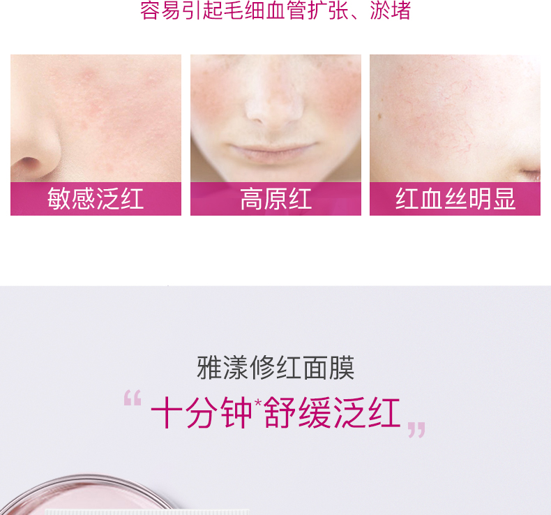 雅漾（Avene）补水喷雾爽肤水化妆水雅漾喷雾舒泉水舒缓敏感肌 【SOS】修红舒缓面膜50ml
