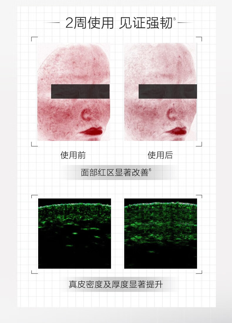 薇诺娜 WINONA舒缓保湿特护精华液5ml 修护肌肤屏障维稳补水滋润 敏感肌可用