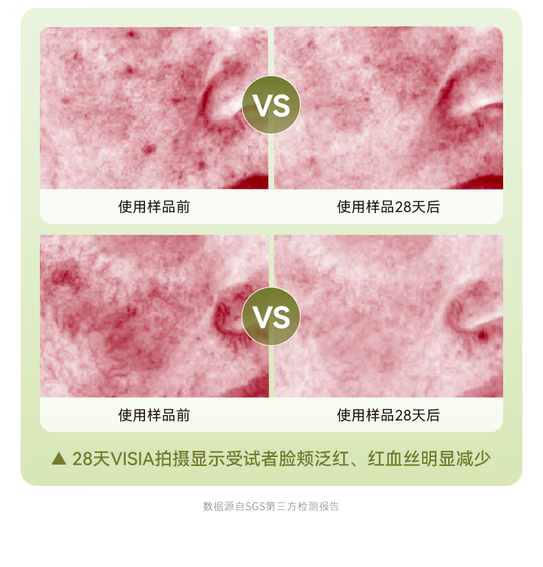 HBN【38同价】视黄醇精华乳液双a醇抗皱提拉紧致淡化皱纹补水保湿 120ml
