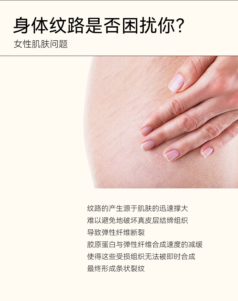 frei ol福来抚纹油产前防孕纹精华油植物【临期品】 200mL