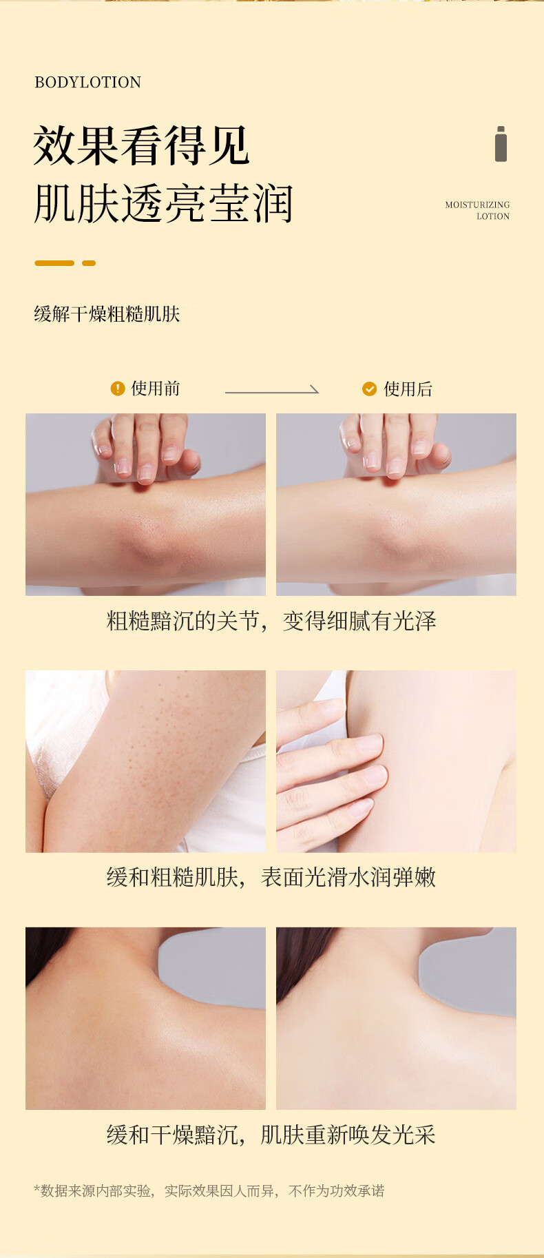 玫黛琳止痒润肤露身体美妆秋冬季保湿皮肤干燥起皮清爽不粘腻润肤工具 1瓶