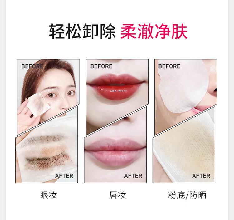 贝德玛（BIODERMA）法国贝德玛卸妆水柔肤水面部卸妆液温和清洁无刺激敏感肌适用 【柔澈净肤敏肌安心】粉水1瓶 500ml/瓶
