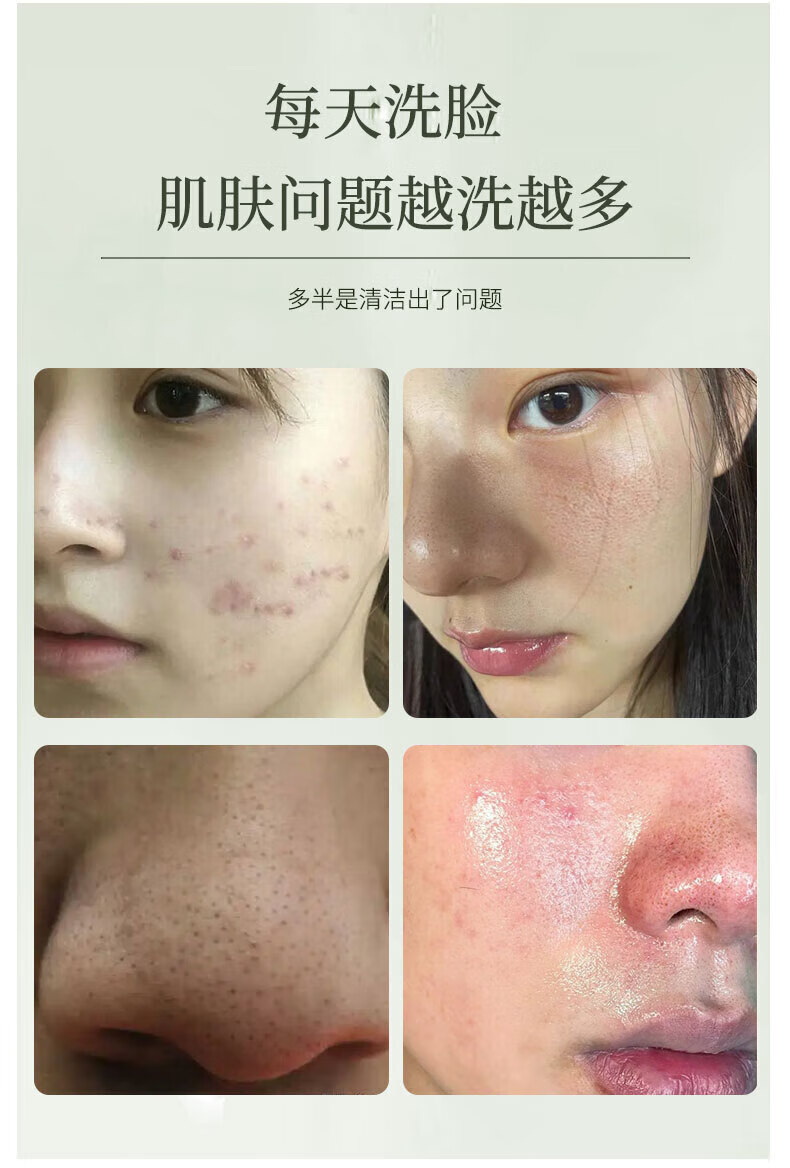 DRAR叶绿素洗面奶氨基酸洁面泥官方去清洁黑头毛孔祛旗舰油痘收缩男女 1瓶100g【下单即贈起泡网】