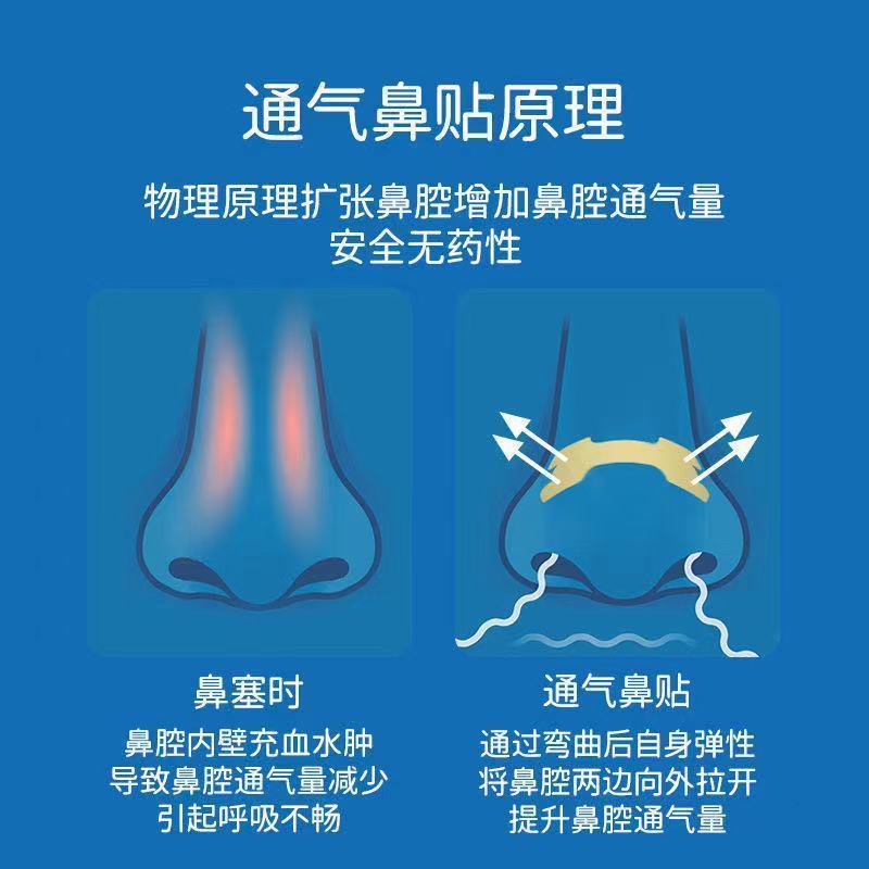 药房直售通气鼻贴儿童型成人型鼻子不通气止鼾宝宝婴儿鼻塞贴棉签环孤
