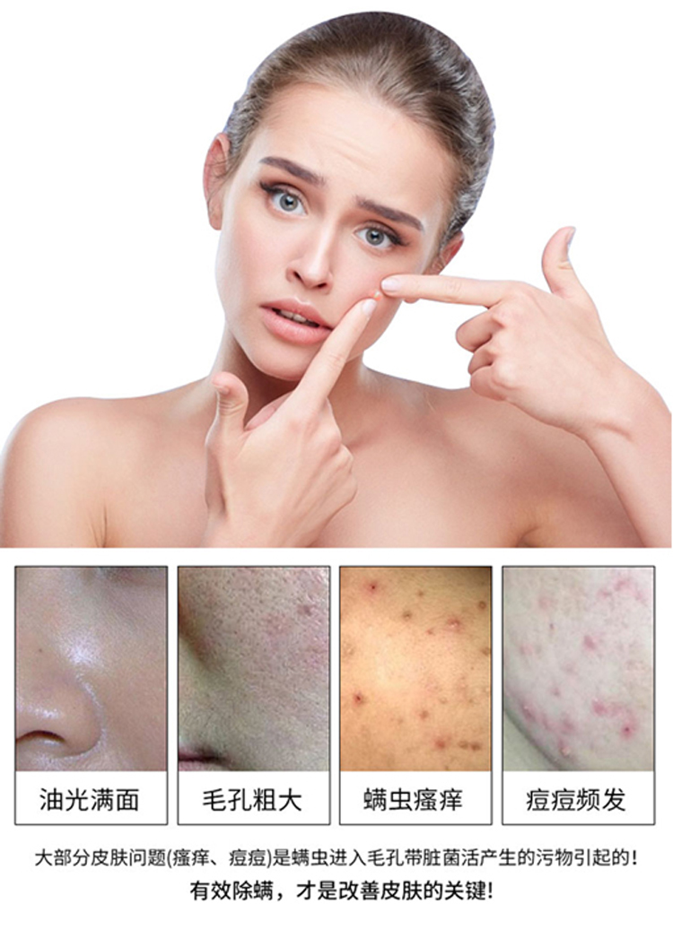 除螨净痘聚然除螨皂硫磺皂控油去面部螨虫祛痘海盐皂马油洗澡肥皂洗脸