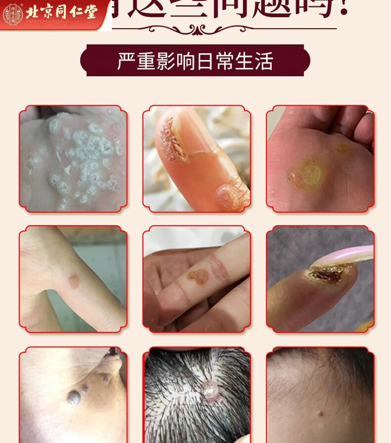 鸦胆子油20ml 膏1瓶【图片 价格 品牌 报价】-京东