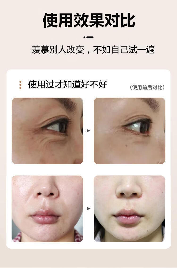 hkcq【官方旗舰】尚赫美容仪 尚赫tbs超声波美容仪器导入脸部提拉理疗