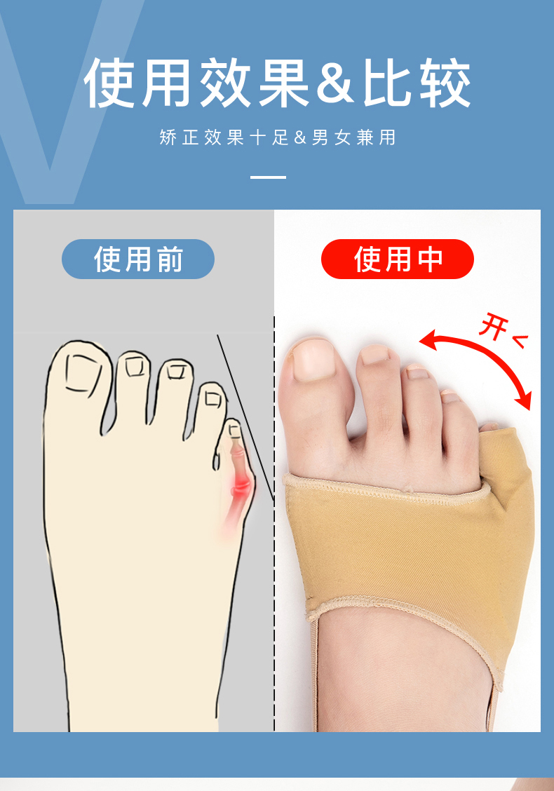 可穿鞋小脚趾内翻矫正器尾指弯曲固定纠正带拇指外翻大脚骨矫形器