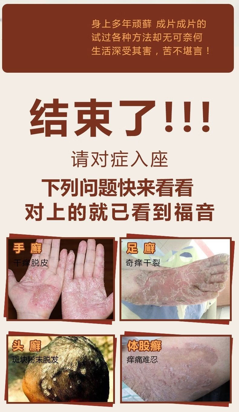 艾夫特百草膏芙贝乐百草肤清霜湿iii疹皮iii炎牛ii皮i荨i麻i疹大腿