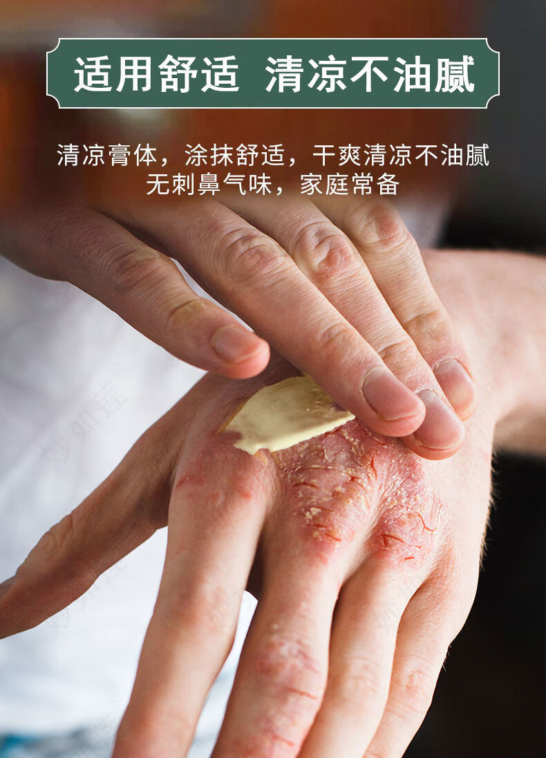 【官方旗舰】怀府虎灵 百年虎毒膏全身皮肤大腿内侧肛门屁眼阴囊外阴