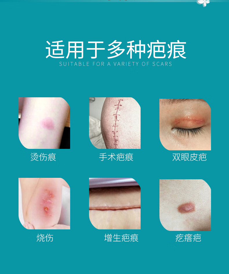 舒巴宁舒疤宁医用硅酮凝胶敷料祛疤膏去疤膏术后增生疤痕烫伤烧伤淡化