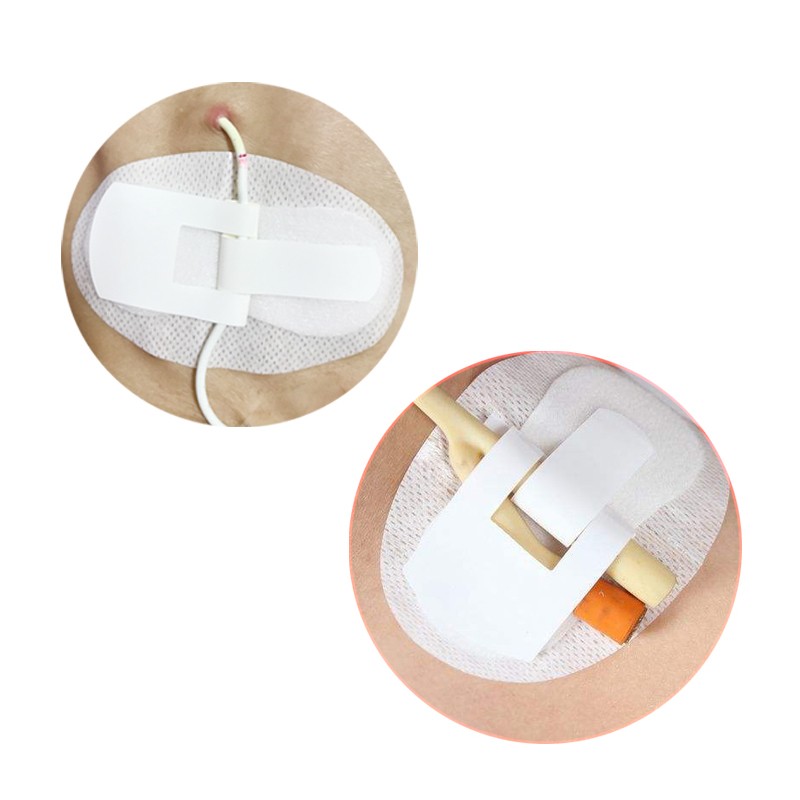 医用导尿管固定贴 体表导管固定装置 引流管固定贴c1 导管绑带尿管贴