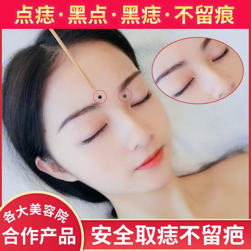 去痣祛痣点痣祛班水笔贴脸部无痕灵修复液水取痣除痣祛痣灵一瓶