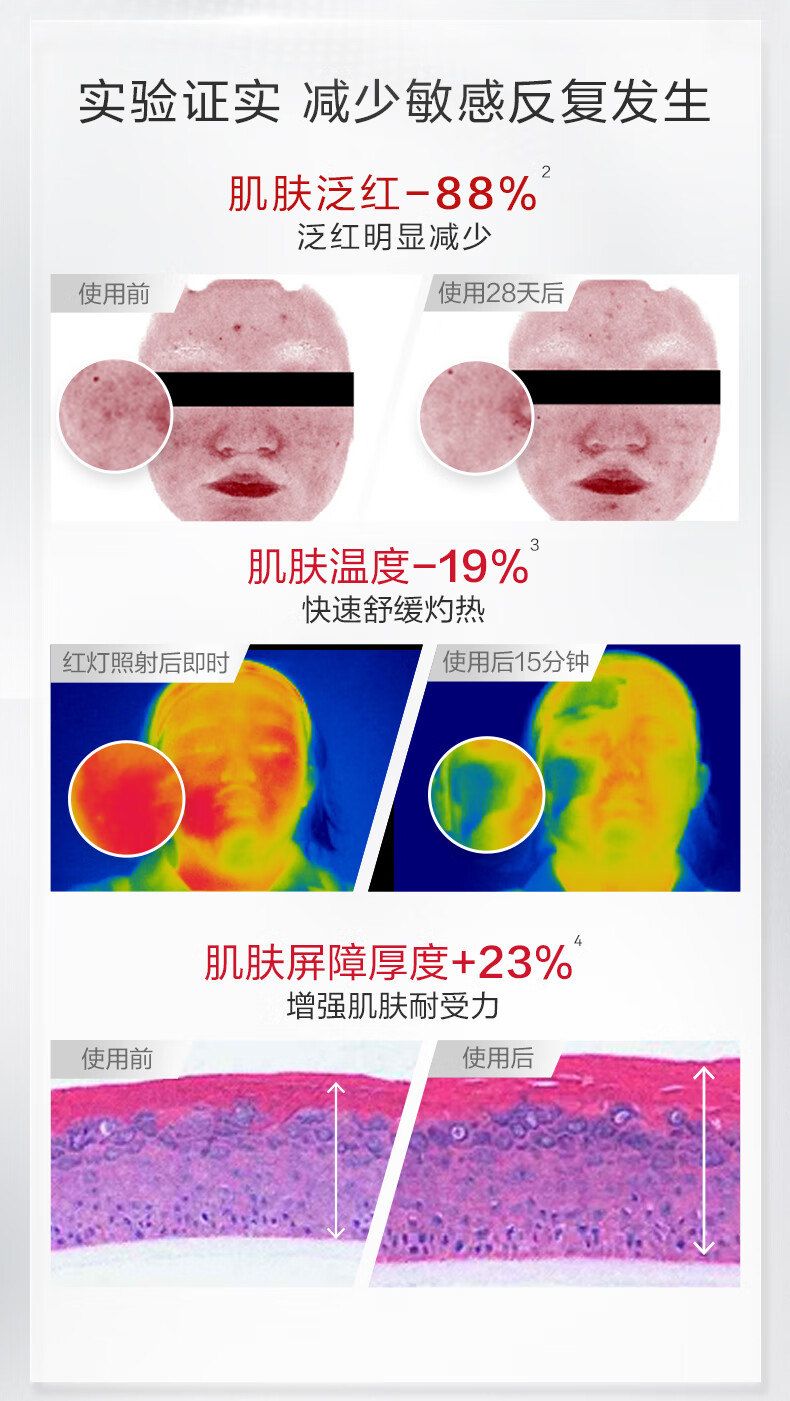 薇诺娜（WINONA）【重磅升级】第二代舒敏保湿特护霜50g 保湿面霜滋润舒缓敏感肌修