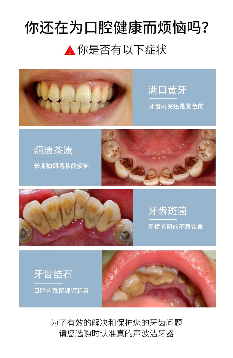 牙结石和牙垢的区别图片