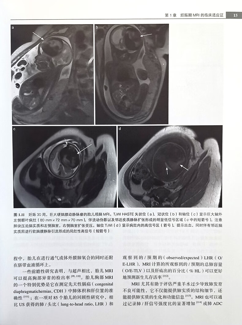 胎兒與妊娠期母體疾病磁共振成像 嚴訓濤 陳偉 蔡萍 王榮品主譯 北京