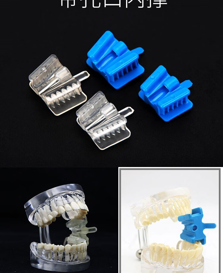 器口腔咬合垫牙科张口器口腔撑嘴器扩张 口内撑套装颜色随机【图片