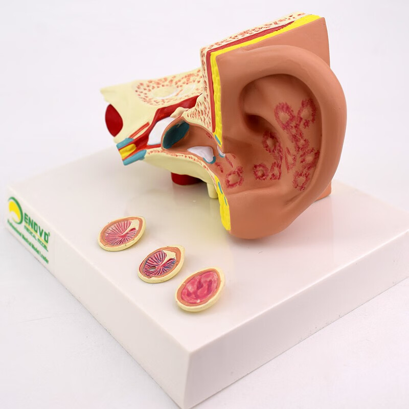 enovo頤諾耳朵常見病理解剖結構模型中耳炎耳穿孔鼓膜炎耳鳴耳聾腫瘤