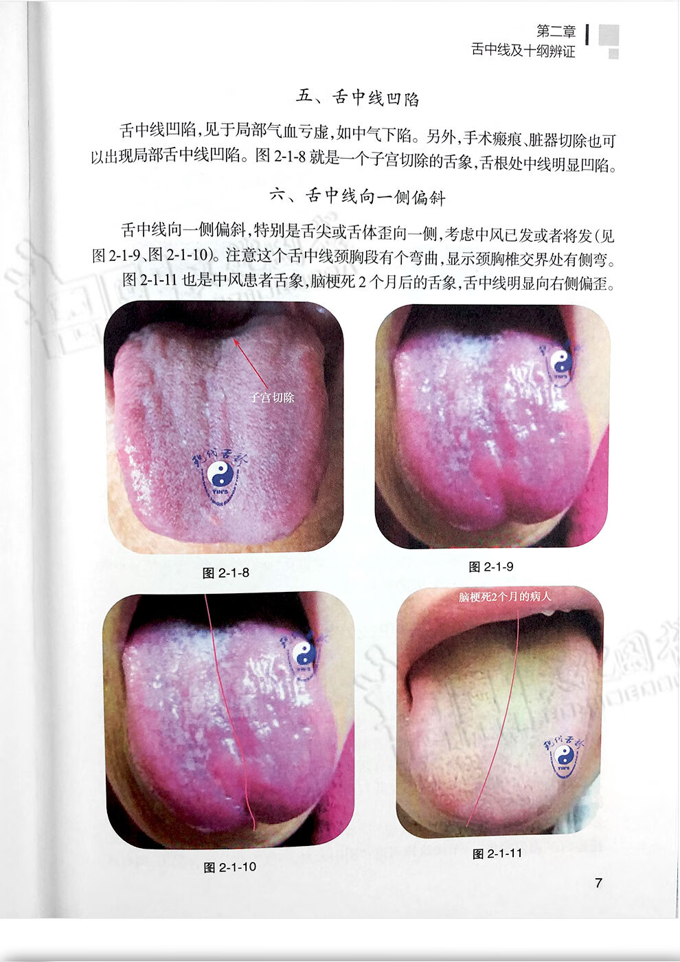 殷氏现代舌诊原理与图谱中医海外赤子学术文丛人民卫生出版社
