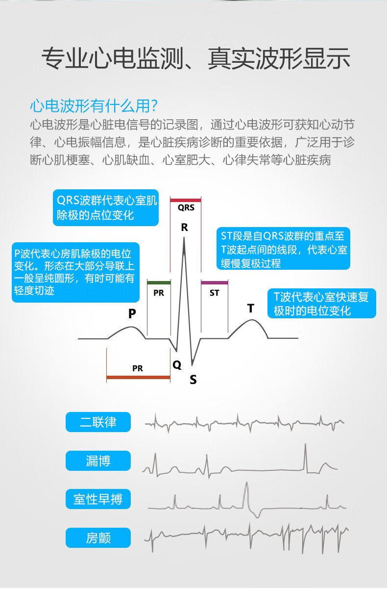 24小时心电图注意事项图片