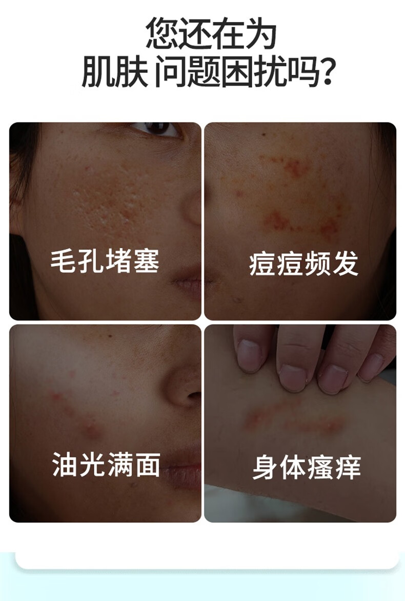 灰妮子其他美妆工具 洗脸清洁硫磺皂沐浴肥皂洗衣皂清洁面部 80g*6块装