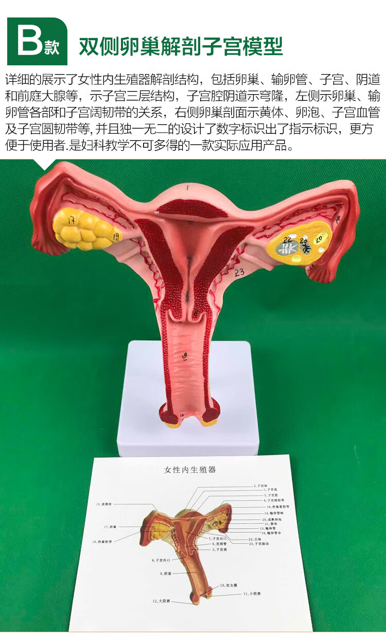 人体子宫模型教学模具模型双侧卵巢解剖子宫模型医患沟通示教
