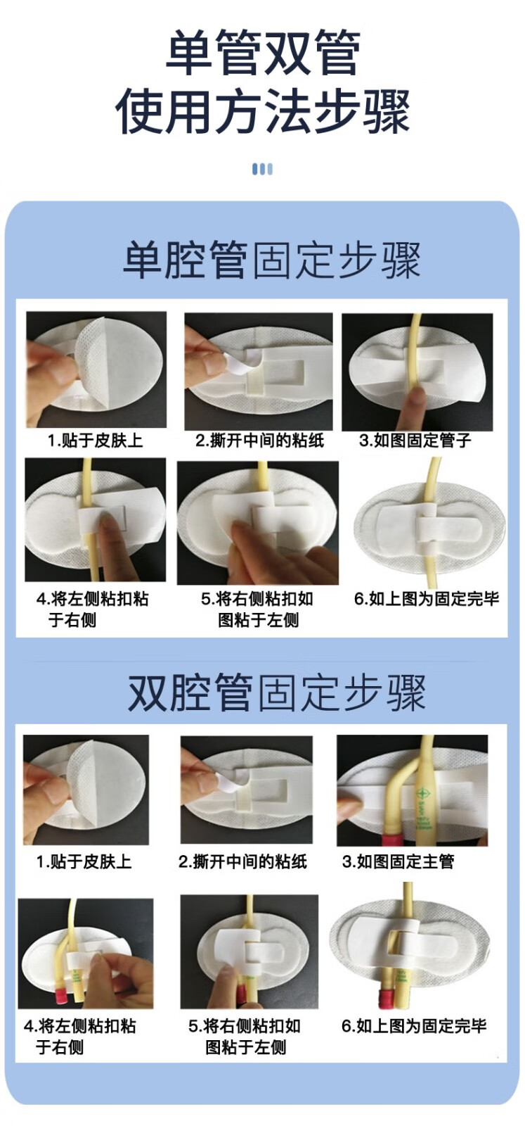 尿管固定腿上方法图片图片