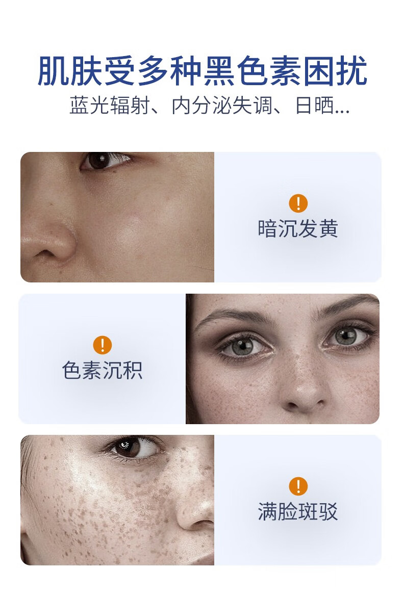 EXPRESSIONS爱碧生进口美白祛斑霜男女士淡斑面霜去雀斑晒斑黄褐斑淡化黑色素 【体验装】10g