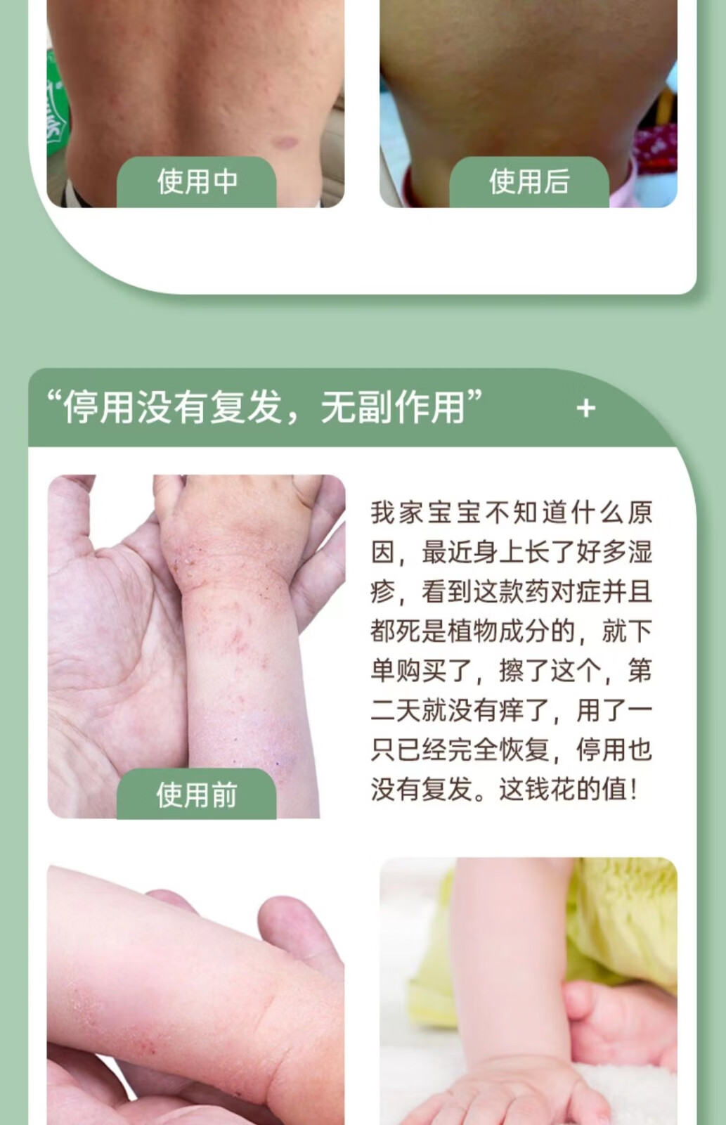 型邦恒丰康舒艾苗软膏旗舰店优乐成臣皮肤抑菌达康官方臣草本乳膏 三