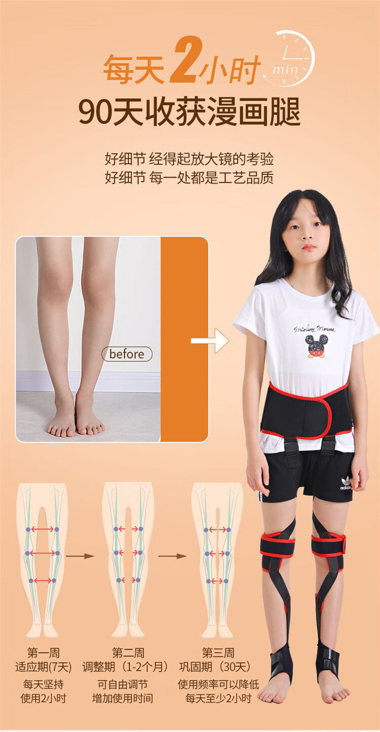 适用于儿童腿型矫正器内八字矫正带x型o型学生罗圈腿绑腿带外八字豪华