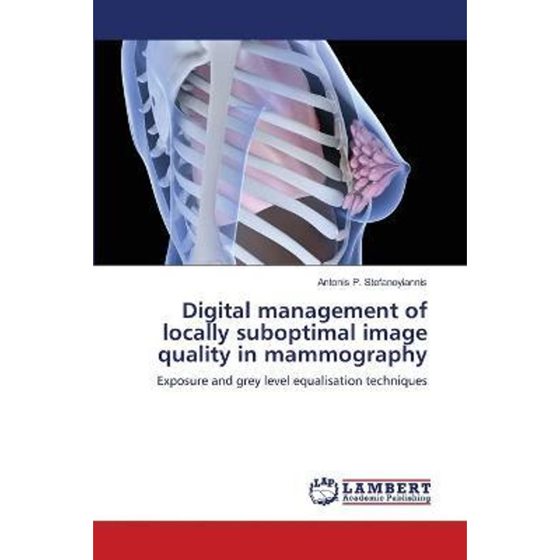 按需印刷Digital management of locally suboptimal image quality in mammography[9783838380421]