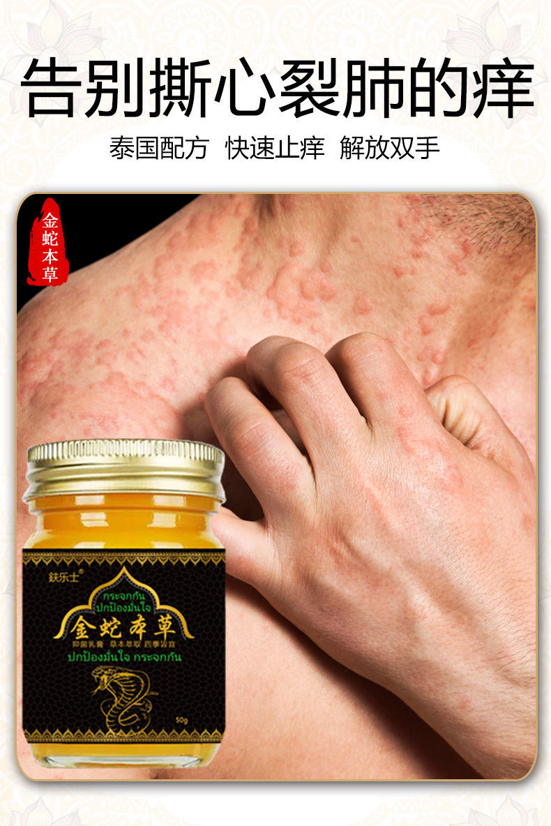泰国配方专用皮肤瘙痒体偏方金蛇本草乳膏 6瓶装严重患者【疗程 巩固