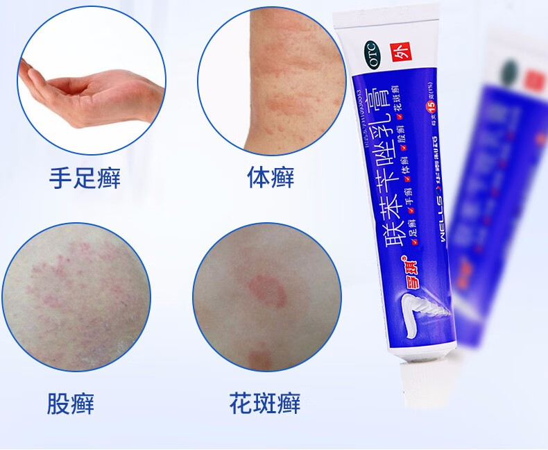 孚琪联苯苄唑乳膏15gotc用于皮肤真菌病手癣足癣体癣股癣花斑癣等1