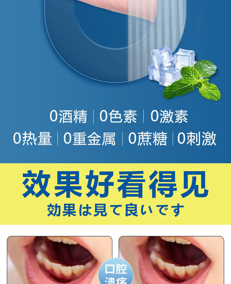 【日本进口】拓实e型牙仕康神经上火牙痛牙龈肿痛蛀虫牙龋齿喷剂 发5