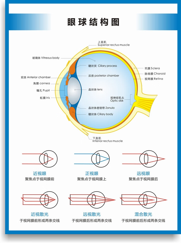 结构图眼球的构造眼睛穴位按摩眼保健操眼科海报挂图眼球构造示意图