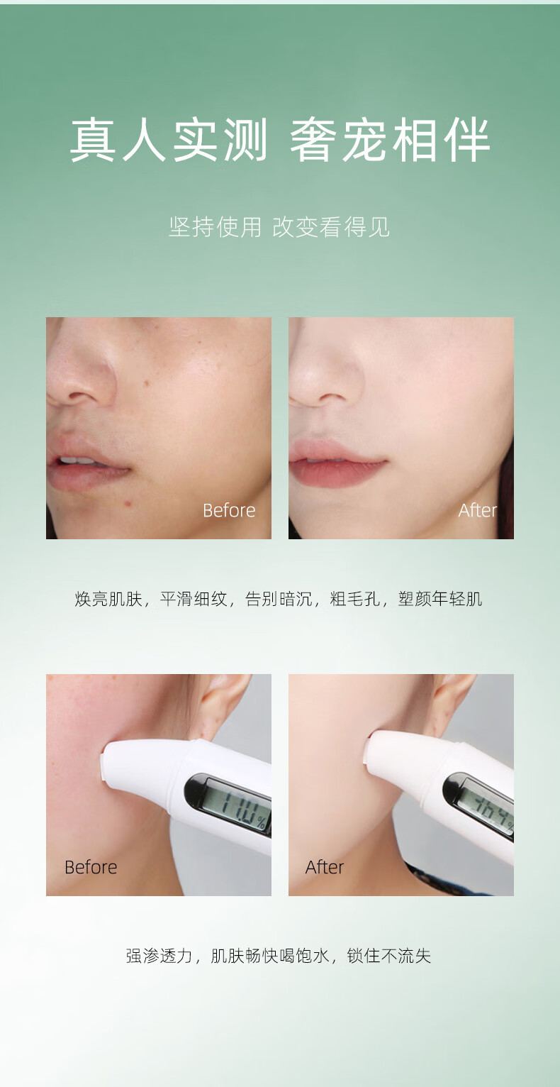 TWG壬二酸凝胶15%水杨酸净颜凝露去黑头收缩毛孔霜去粉刺 祛痘膏 TWG水杨酸细致毛孔霜