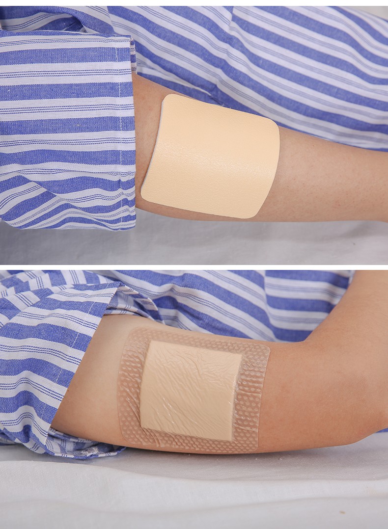 赛肤康瑞skinkangrui硅胶型