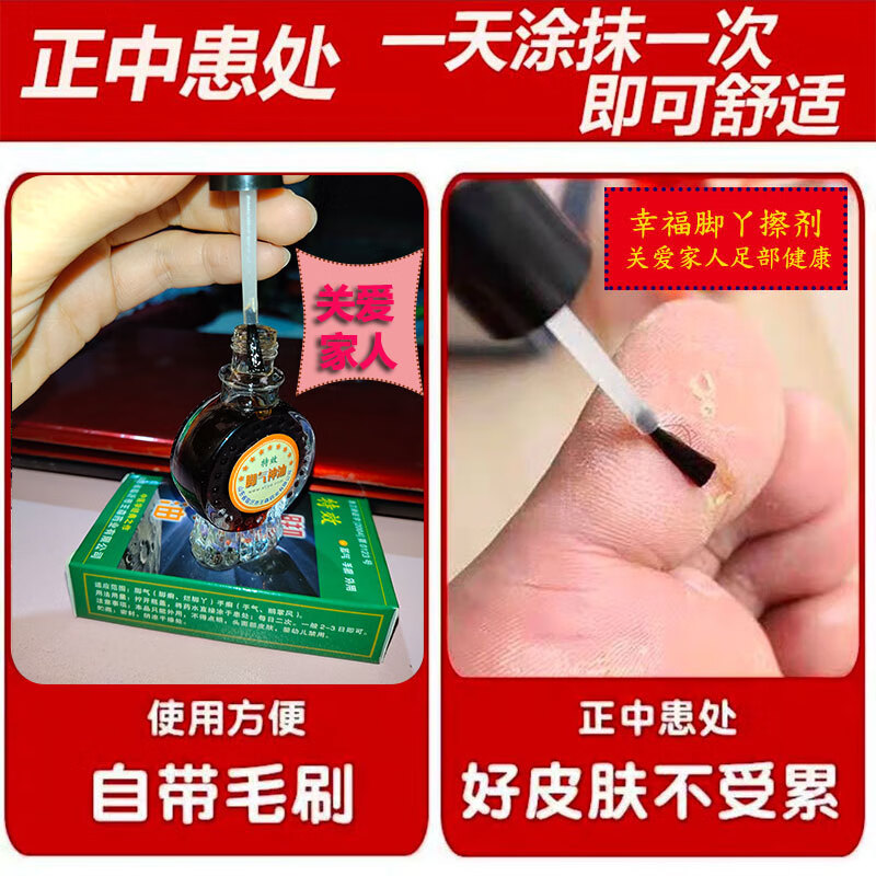 山东临沂王森脚气神油脚痒水泡丫止痒脱皮足20ml 1瓶装【图片 价格